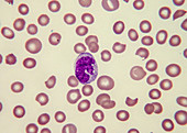 Monocyte, LM