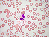 Phagocytosis, LM