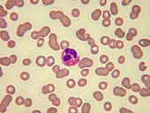 Eosinophilic leucocyte, LM