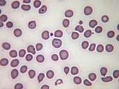 Red blood cell inclusion, LM
