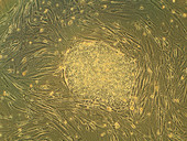 Human Stem Cells