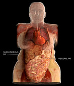 Visceral and Subcutaneous Fat