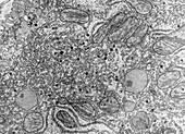 Endoplasmic Reticulum in Liver Cell TEM