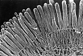 Brush Border of Intestinal Absorptive Cell, SEM