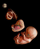 Fetus Growth