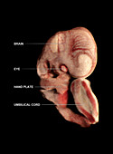 Embryo, Week 8