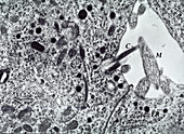 Pancreatic endocrine cell cilia, TEM