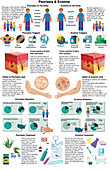 Comparing Psoriasis and Eczema, Infographic