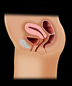 Female Reproductive Anatomy, Illustration