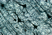 Cerebral Cortex Pyramidal Cells, LM
