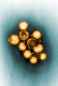 Orthomyxovirus, Influenza A Virus, TEM