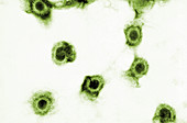Cytomegalovirus, TEM