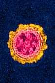 Influenza virus, TEM