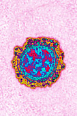 Influenza virus, TEM