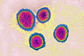 Coronavirus, TEM