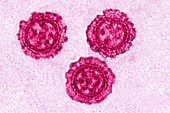 Influenza virus, TEM