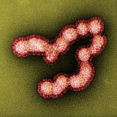 SW31, Swine Flu Strain Virus, TEM