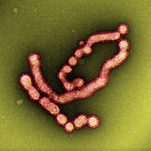 SW31, Swine Flu Strain Virus, TEM