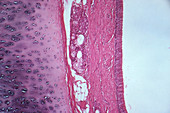 Trachea, LM