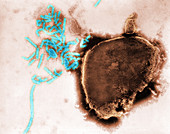 Paramyxovirus, Mumps Virus, TEM