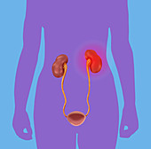 Kidney Pain, Illustration