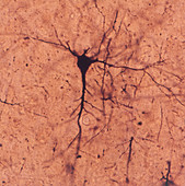 Cerebrum Pyramidal Cells Axons & Dendrites