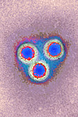 Hepatitis A virus, TEM