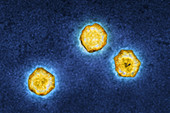 Hepatitis A virus, TEM