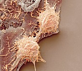 Natural killer cells and cancer cell, SEM