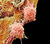 Natural killer cells and cancer cell, SEM