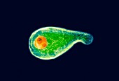 Mycoplasma genitalium bacterium, TEM