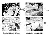 Irradiated brain sections, comparing micrographs