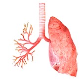 Illustration of the human lung and bronchi