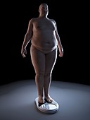 Illustration of an obese man on a scale