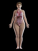 Illustration of an obese woman's organs