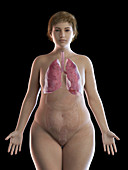 Illustration of an obese woman's lung