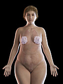 Illustration of an obese woman's mammary glands