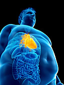 Illustration of an obese man's heart