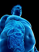 Illustration of an obese man's organs