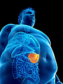 Illustration of an obese man's spleen