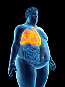 Illustration of an obese man's lungs