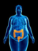 Illustration of an obese man's colon