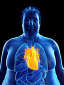 Illustration of an obese man's heart