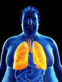 Illustration of an obese man's lungs