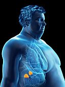 Illustration of an obese man's adrenal glands