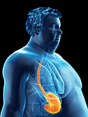 Illustration of an obese man's stomach