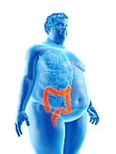Illustration of an obese man's colon