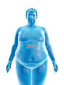 Illustration of an obese man's adrenal glands
