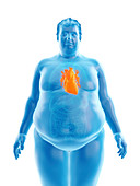 Illustration of an obese man's heart