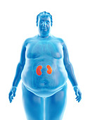 Illustration of an obese man's kidneys